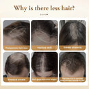 Biotin Hair Growth Thicken Oil Products for Men Women Preventive Anti Hair Loss Fast Regrowth Scalp Treatment Repair Hair Care