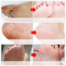 Herbal Anti Crack Foot Cream Spray Heel Cracking Repair Products Exfoliation Dead Skin Removal Softening Moisturize Smooth Care