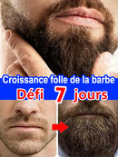 The most effective beard growth essence in 2025, grow a thick beard in 7 days. Chest hair, leg hair, beard and hair growth