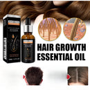 High Repurchase,Hair Growth Oil,Biotin DHT Blocker,Anti-Loss Shampoo,Boost Regrowth,Increase Production of Shampoo,hair Growth