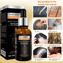 High Repurchase,Hair Growth Oil,Biotin DHT Blocker,Anti-Loss Shampoo,Boost Regrowth,Increase Production of Shampoo,hair Growth