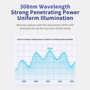 Treatment of vitiligo psoriasis with 311 NM narrow-band ultraviolet light by UVB phototherapy instrument