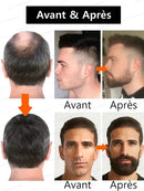 The most effective beard growth essence in 2025, grow a thick beard in 7 days. Chest hair, leg hair, beard and hair growth
