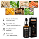 High Repurchase,Hair Growth Oil,Biotin DHT Blocker,Anti-Loss Shampoo,Boost Regrowth,Increase Production of Shampoo,hair Growth